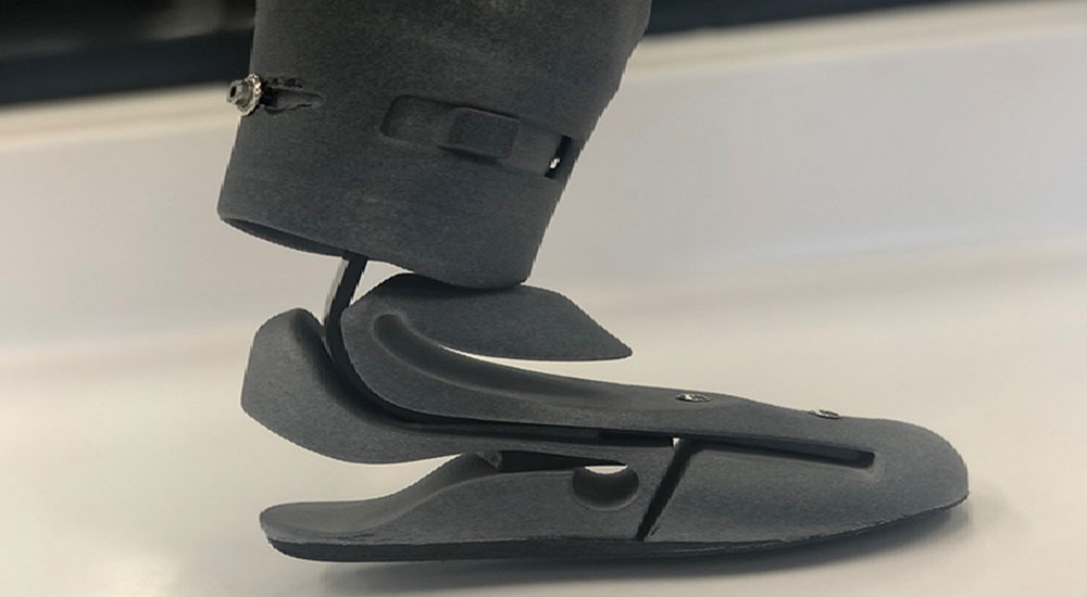 Jumbo Group partners with MOBILIS for 3D printing of orthotics and prosthetics parts